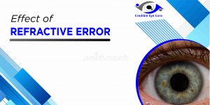 Effect of Refractive Error